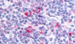 GPRC5D Antibody in Immunohistochemistry (Paraffin) (IHC (P))