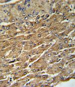 GPT Antibody in Immunohistochemistry (IHC)