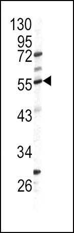 GPT Antibody in Western Blot (WB)