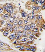 GRB2 Antibody in Immunohistochemistry (IHC)
