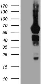 GRB7 Antibody in Western Blot (WB)