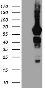 GRB7 Antibody in Western Blot (WB)