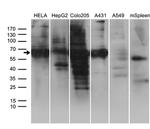 GRB7 Antibody in Western Blot (WB)