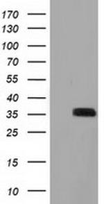 GRHPR Antibody in Western Blot (WB)
