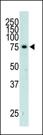 GRK3 Antibody in Western Blot (WB)