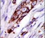 GRK5 Antibody in Immunohistochemistry (IHC)