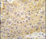 GRK5 Antibody in Immunohistochemistry (IHC)
