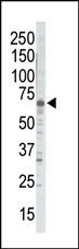 GRK5 Antibody in Western Blot (WB)