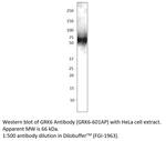 GRK6 Polyclonal Antibody