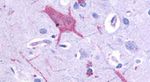 mGluR1 Antibody in Immunohistochemistry (Paraffin) (IHC (P))
