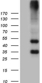 GRM4 Antibody in Western Blot (WB)