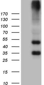 GRM4 Antibody in Western Blot (WB)
