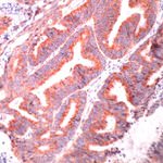 HSPA9 Antibody in Immunohistochemistry (IHC)