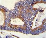 GRP78 Antibody in Immunohistochemistry (IHC)
