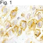 GRPR Antibody in Immunohistochemistry (IHC)
