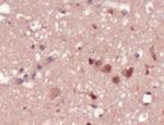 GRSF1 Antibody in Immunohistochemistry (IHC)