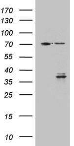 GSG1 Antibody in Western Blot (WB)