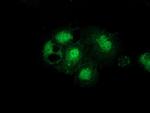 GSS Antibody in Immunocytochemistry (ICC/IF)