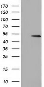 GSS Antibody in Western Blot (WB)