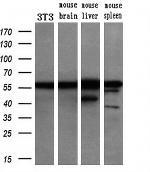 GSS Antibody in Western Blot (WB)