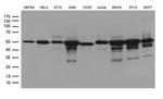 GSS Antibody in Western Blot (WB)