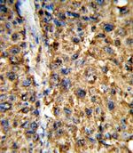GSTA2 Antibody in Immunohistochemistry (IHC)