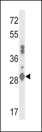 GSTA2 Antibody in Western Blot (WB)