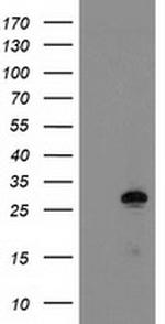 GSTO2 Antibody in Western Blot (WB)