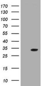 GSTO2 Antibody in Western Blot (WB)