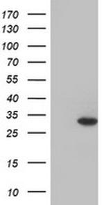 GSTO2 Antibody in Western Blot (WB)