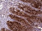 GSTP1 Antibody in Immunohistochemistry (Paraffin) (IHC (P))