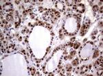 GSTP1 Antibody in Immunohistochemistry (Paraffin) (IHC (P))