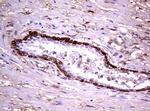 GSTP1 Antibody in Immunohistochemistry (Paraffin) (IHC (P))