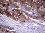 GSTP1 Antibody in Immunohistochemistry (Paraffin) (IHC (P))