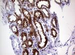 GSTP1 Antibody in Immunohistochemistry (Paraffin) (IHC (P))