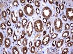 GSTP1 Antibody in Immunohistochemistry (Paraffin) (IHC (P))