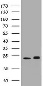 GSTP1 Antibody in Western Blot (WB)