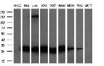 GSTP1 Antibody in Western Blot (WB)