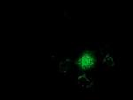 GSTT2 Antibody in Immunocytochemistry (ICC/IF)