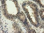 GSTT2 Antibody in Immunohistochemistry (Paraffin) (IHC (P))