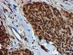 GSTT2 Antibody in Immunohistochemistry (Paraffin) (IHC (P))
