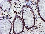 GSTT2 Antibody in Immunohistochemistry (Paraffin) (IHC (P))