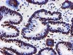 GSTT2 Antibody in Immunohistochemistry (Paraffin) (IHC (P))