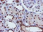 GSTT2 Antibody in Immunohistochemistry (Paraffin) (IHC (P))