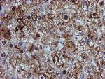GSTT2 Antibody in Immunohistochemistry (Paraffin) (IHC (P))