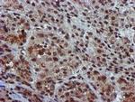 GSTT2 Antibody in Immunohistochemistry (Paraffin) (IHC (P))