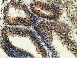 GSTT2 Antibody in Immunohistochemistry (Paraffin) (IHC (P))