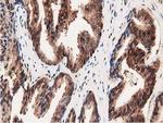 GSTT2 Antibody in Immunohistochemistry (Paraffin) (IHC (P))