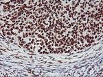 GSTT2 Antibody in Immunohistochemistry (Paraffin) (IHC (P))