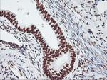 GSTT2 Antibody in Immunohistochemistry (Paraffin) (IHC (P))
